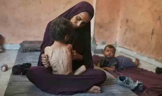 Gazze’de Açlık Krizi: Her Beş Çocuktan Biri Yaşamını Yitiriyor