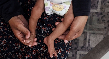 İsrail'in Açlığa Mahkûm Ettiği Gazze'de 266 Kişi Hayatını Kaybetti