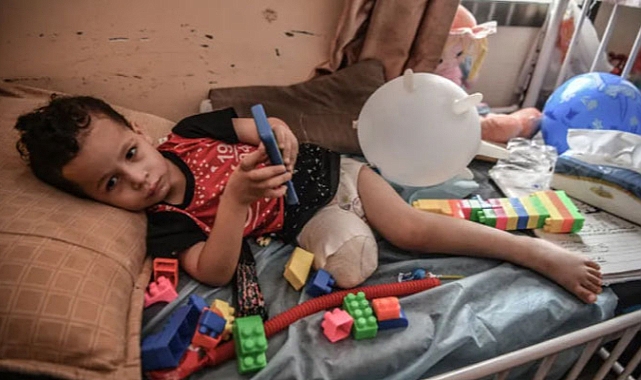 Gazze, nüfusa oranla çocuklarda en yüksek uzuv kaybı oranına sahip bölge oldu