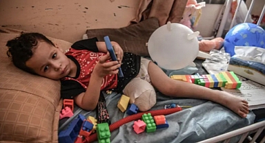 Gazze, nüfusa oranla çocuklarda en yüksek uzuv kaybı oranına sahip bölge oldu