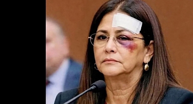 Maduro’nun eşi ABD mahkemesinde yaralı olarak ortaya çıktı