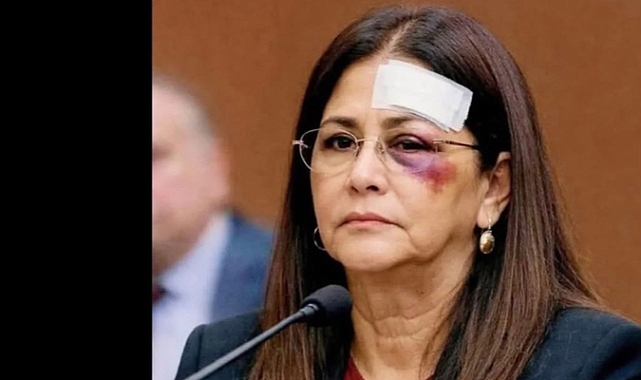 Maduro’nun eşi ABD mahkemesinde yaralı olarak ortaya çıktı