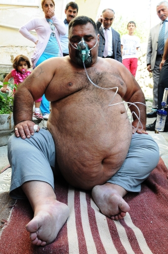 240 kiloluk adam, hastaneye itfaiye ekiplerinin yardımıyla götürüldü