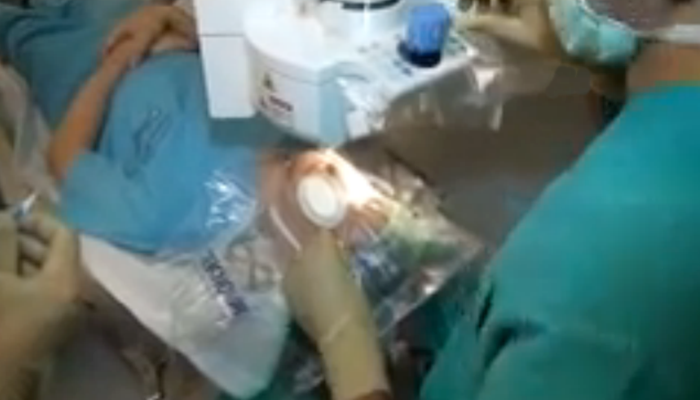 Lazer tedavisi ile gözlüklerden kurtulmak mümkün
