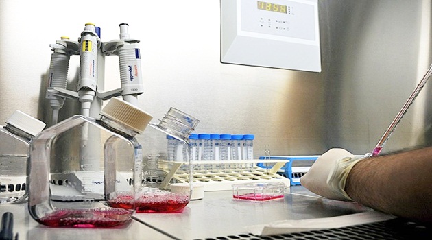 10 milyon kişinin kolesterolü yüksek