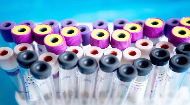 Hepatit B, C ve D virüsleri "sinsi" gelişiyor