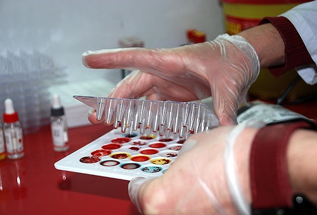 İngiltere'de her iki kişiden biri kanser olacak