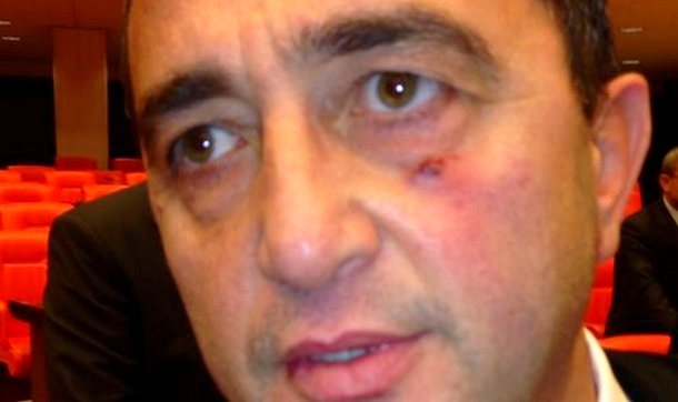 Meclis'te darp edilen CHP'li vekil Bülent Tezcan hastanede
