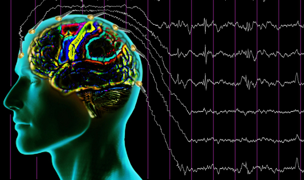Epilepsi hastalığı yüzde 95 oranında tedavi edilebiliyor