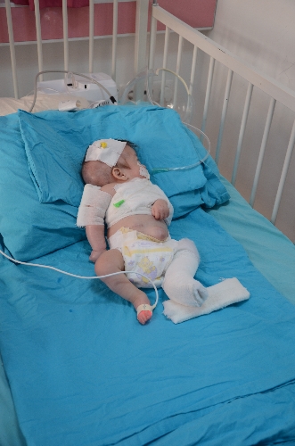 Annesi tarafından darp edilen bebeğin tedavisi sürüyor