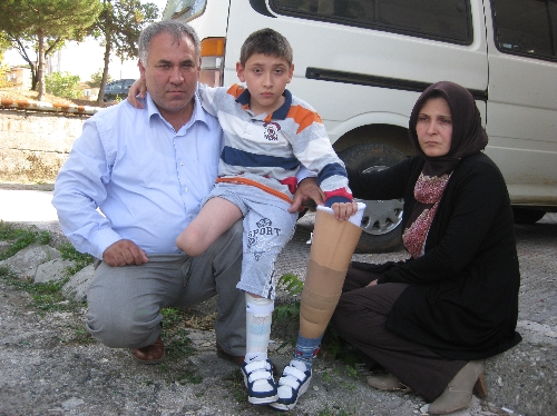 Doktorlar 'hastaneden koşarak çıkacak' dedi, ayağı kesildi
