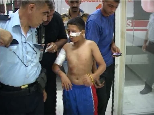 Eve sıkılan kurşunlar balkondaki çocuğu yaraladı