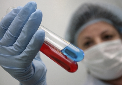 Rusya, Afrika olma yolunda; her gün 200 kişiye HIV virüsü bulaşıyor