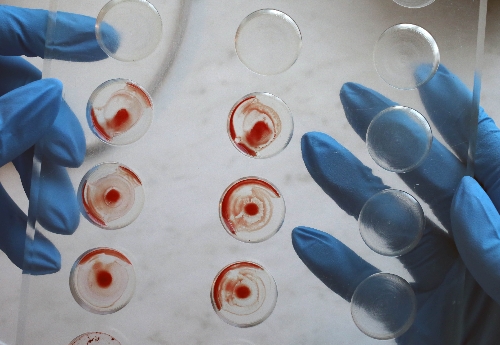 Rusya, Türkiye'den öldürülen Çeçenlerin DNA örneklerini aldı