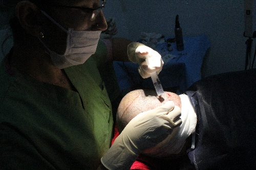Saçı dökülen Araplar İstanbul'a koşuyor